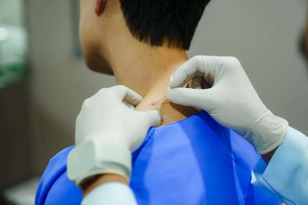 ฝังเข็มแบบ Dry Needling แก้ออฟฟิศซินโดรมเรื้อรัง ?